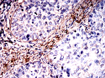 ACTA2 Antibody