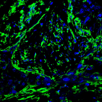 ACTA2 Antibody
