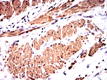 ACTA2 Antibody