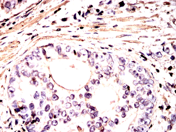 ACTA2 Antibody