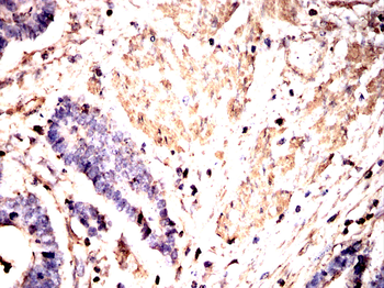 ACTA2 Antibody
