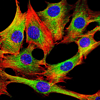 TUBA1B Antibody