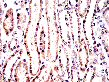 TUBA1B Antibody
