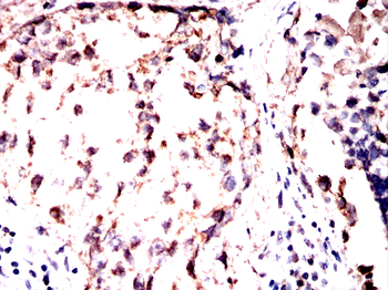 TUBA1B Antibody
