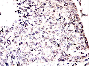 SMAD3 Antibody