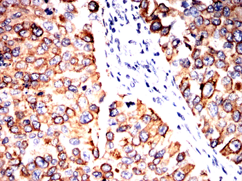 KRT17 Antibody