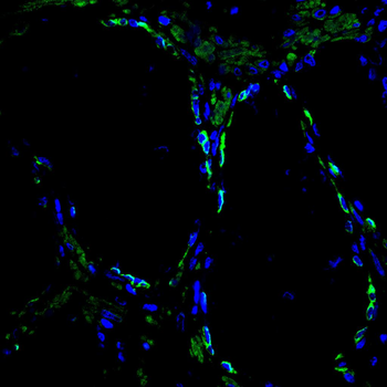 KRT17 Antibody