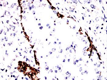 KRT17 Antibody