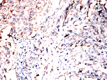 YWHAH Antibody