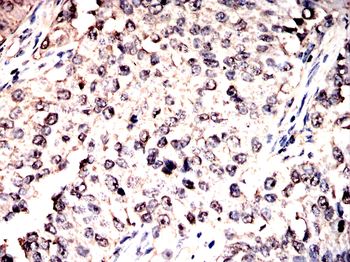 PRDX1 Antibody