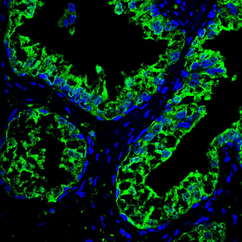 PRDX1 Antibody
