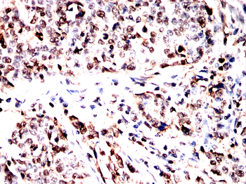 PRKAA1 Antibody
