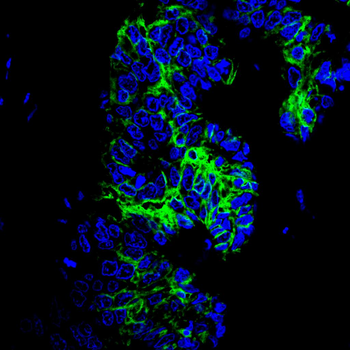 CA9 Antibody