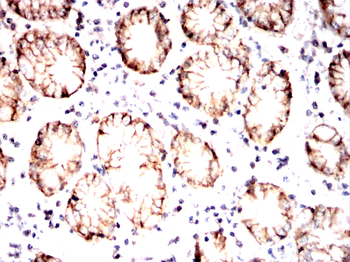 CA9 Antibody