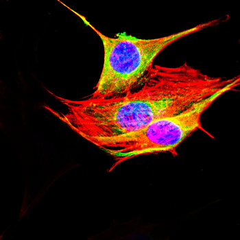 ACE2 Antibody