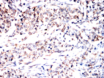 ACE2 Antibody