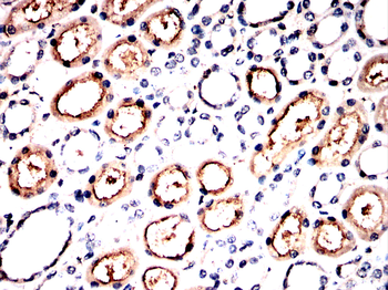 ACE2 Antibody