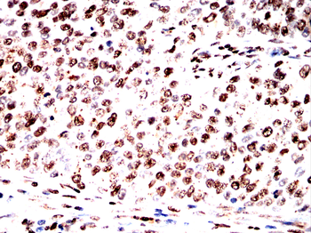 SPHK2 Antibody