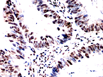 SPHK2 Antibody