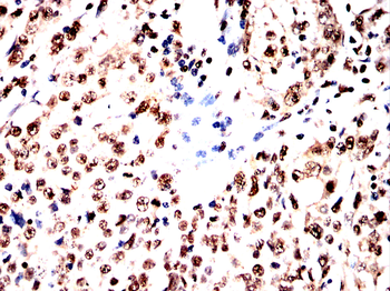 SPHK2 Antibody