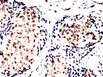 SPHK2 Antibody