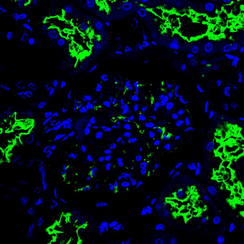 AMACR Antibody