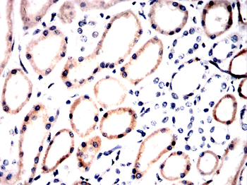 AMACR Antibody