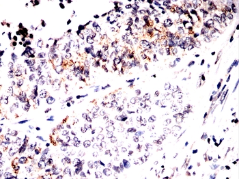 AMACR Antibody