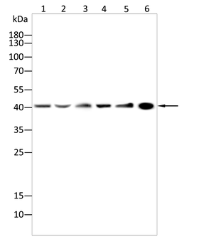 AMACR Antibody
