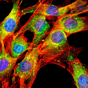 HAO1 Antibody