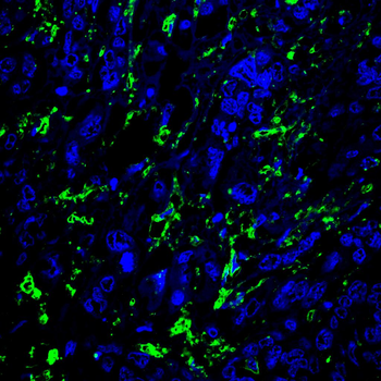 HAO1 Antibody