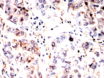 HAO1 Antibody