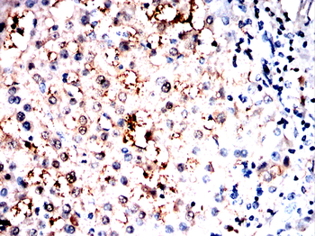 HAO1 Antibody