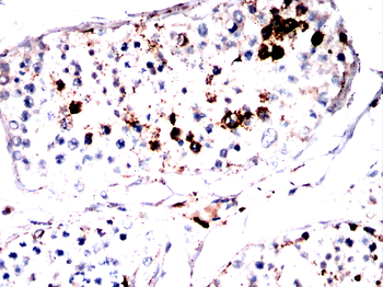HAO1 Antibody