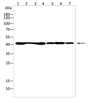 HAO1 Antibody