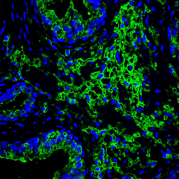 HSPB8 Antibody