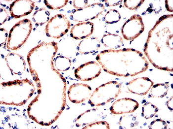 HSPB8 Antibody