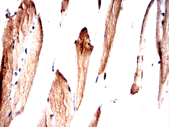 HSPB8 Antibody