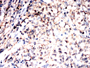 HSPB8 Antibody