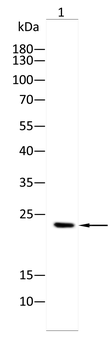 HSPB8 Antibody