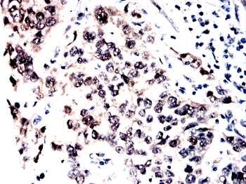YAP1 Antibody