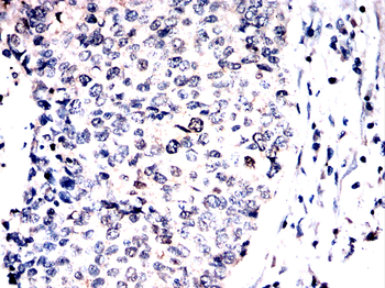 CHEK1 Antibody