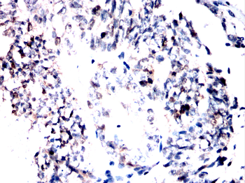 CHEK1 Antibody