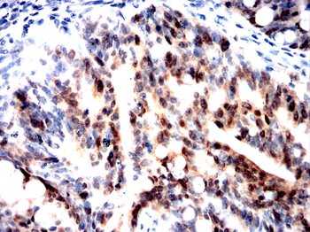 CHEK1 Antibody