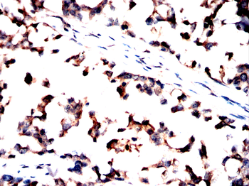 NEDD4 Antibody