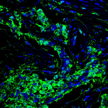 NEDD4 Antibody