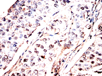 NEDD4 Antibody