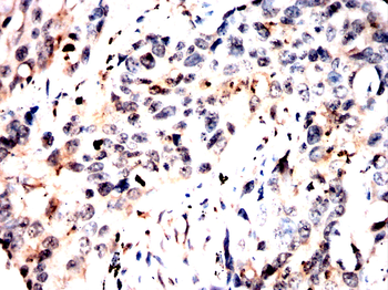 NEDD4 Antibody