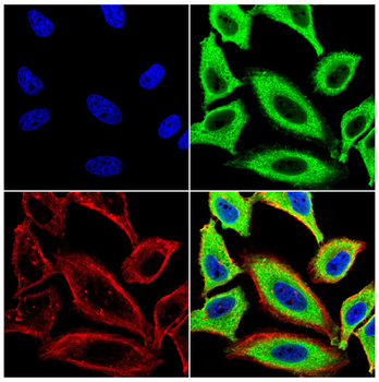 TFRC Antibody