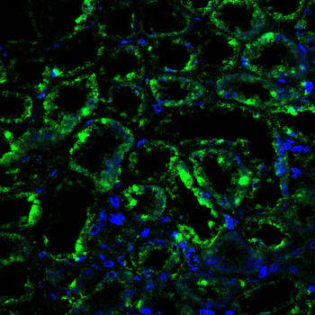 TFRC Antibody